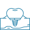 implantes-3